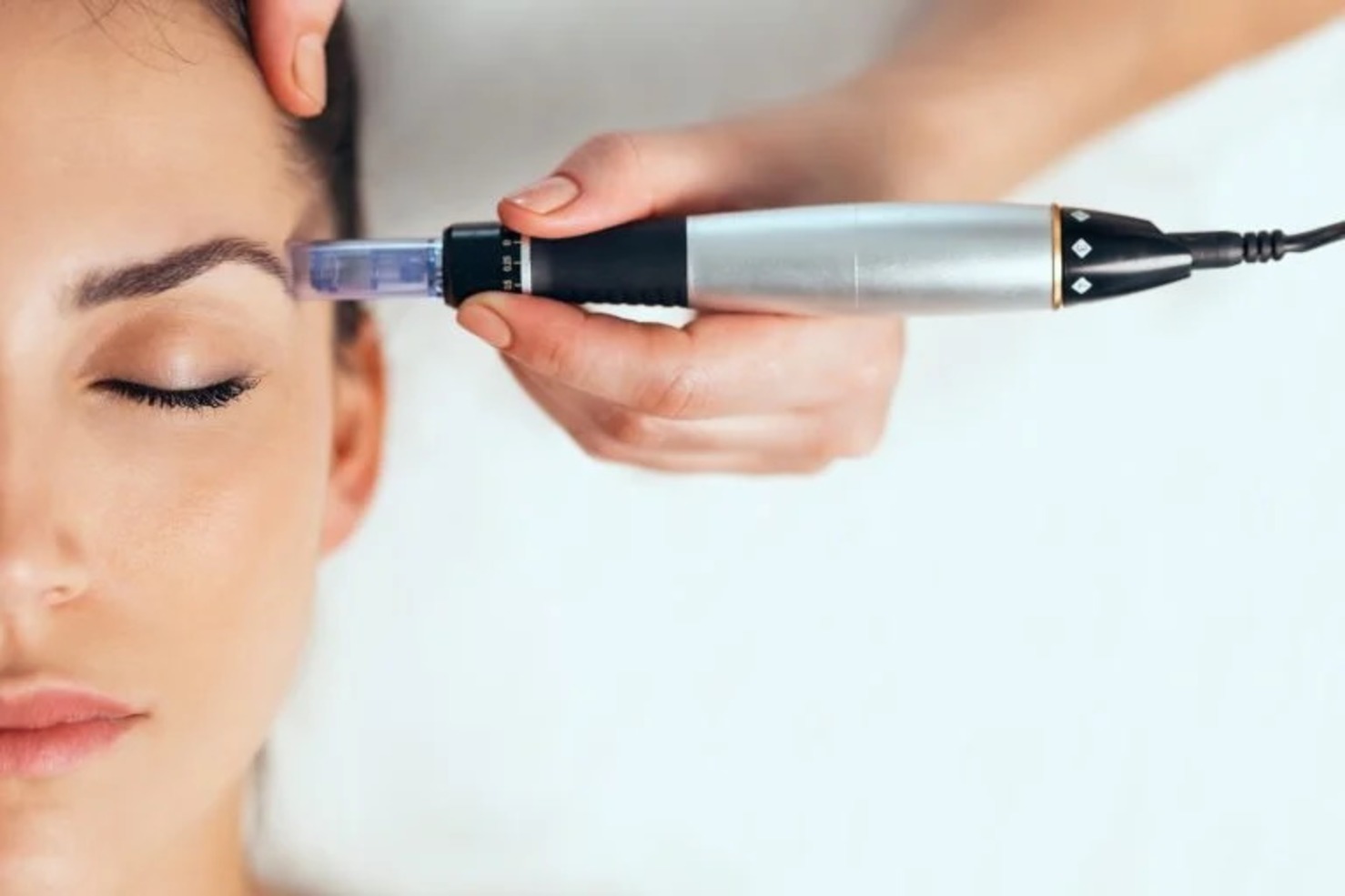 مزونیدلینگ صورت چیست؟ | راهنمای کامل مزونیدلینگ، مزایا و مراقبتها | رژینو